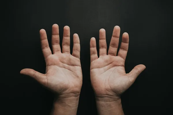 智慧線分叉代表什麼？手相智慧線分叉的位置、類型與運勢詳解